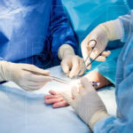 El Cerrahisi ve Mikrocerrahi