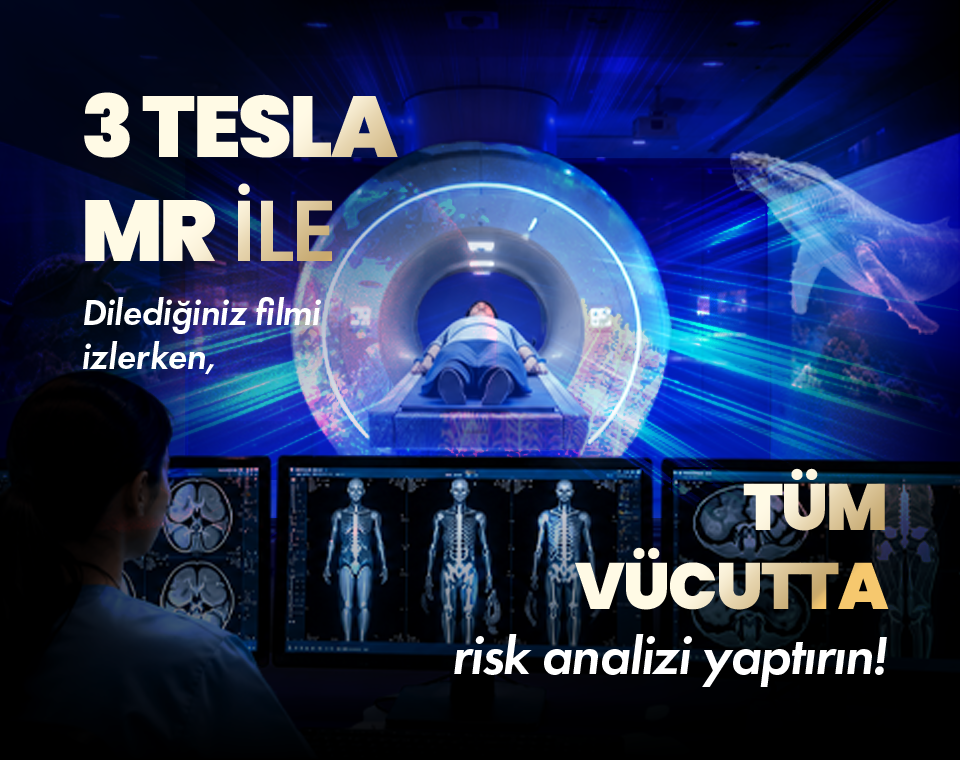 Promotional image of a patient undergoing a 3-Tesla MRI with futuristic monitors, advertising whole-body risk analysis in Turkish.