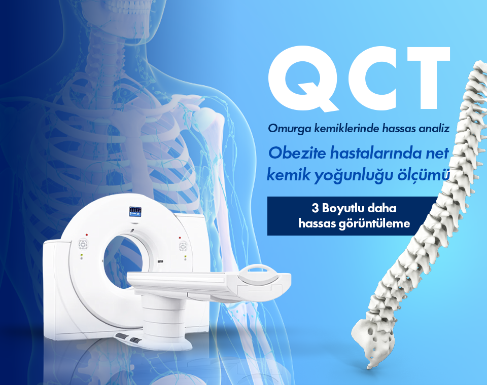 CT scanner in the foreground with a blue gradient background and a spine model on the right, advertising precise vertebral bone density analysis (QCT).