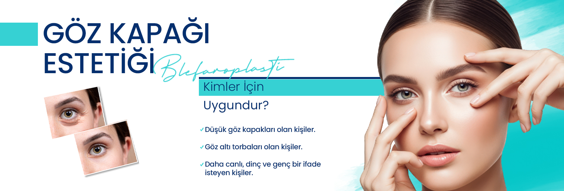 Göz kapağı estetiği için kimler uygun: yazılı içerik ve yüz görseliyle desteklenen reklam afişi.