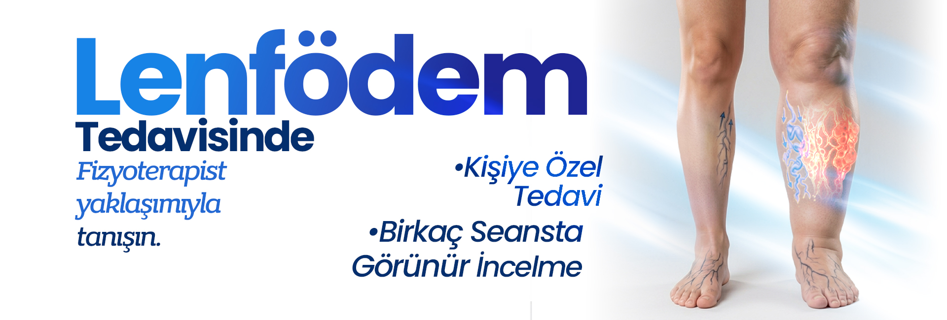 Lenfödem Tedavisi reklam bannerı; bacak üzerinde damar ağı tasviri ve terapi mesajı verir.